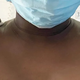 Imagen para el artículo titulado A esta mujer le salió un bulto en la axila tras dar a luz, y entonces comenzó a lactar